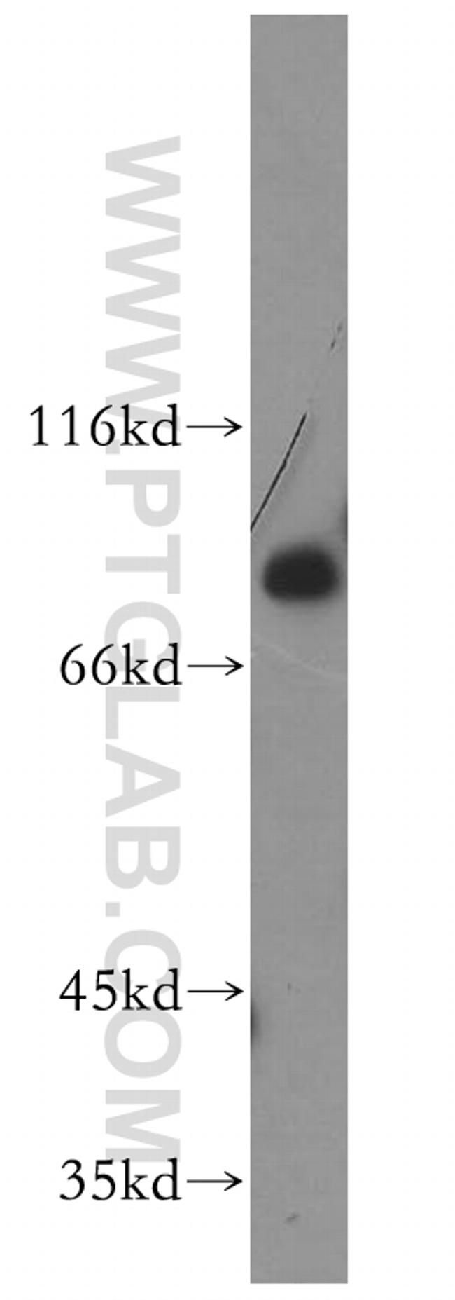 MDMX Antibody in Western Blot (WB)