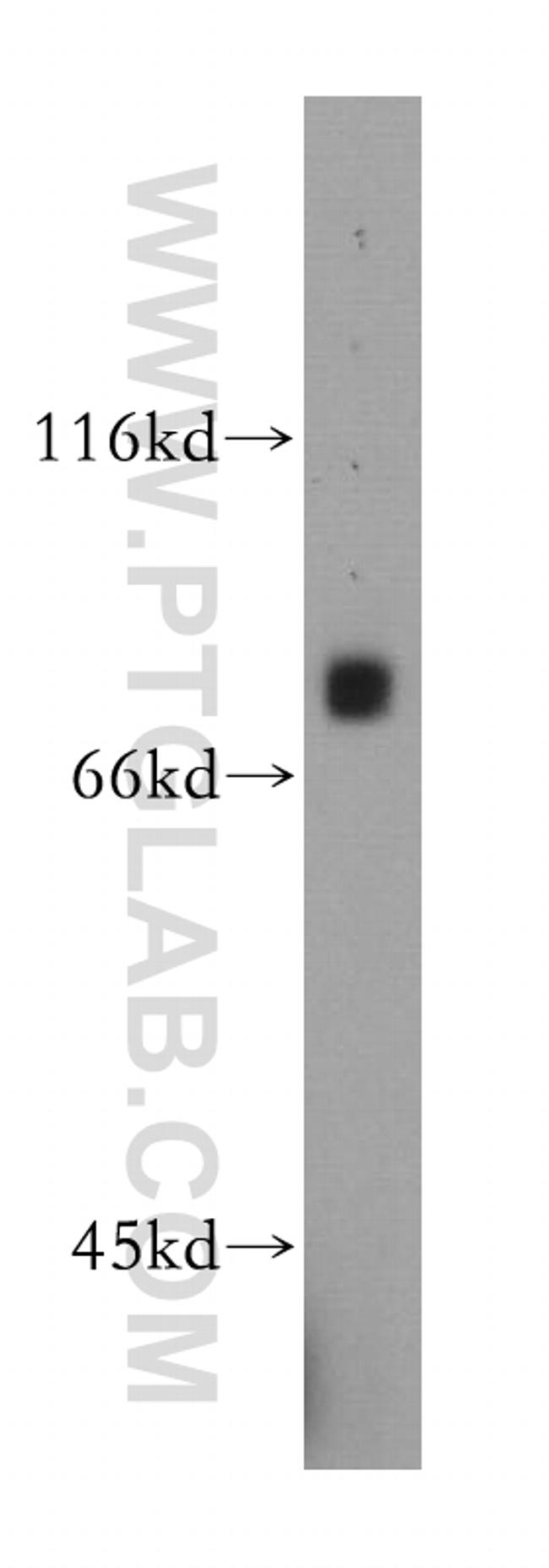 MDMX Antibody in Western Blot (WB)