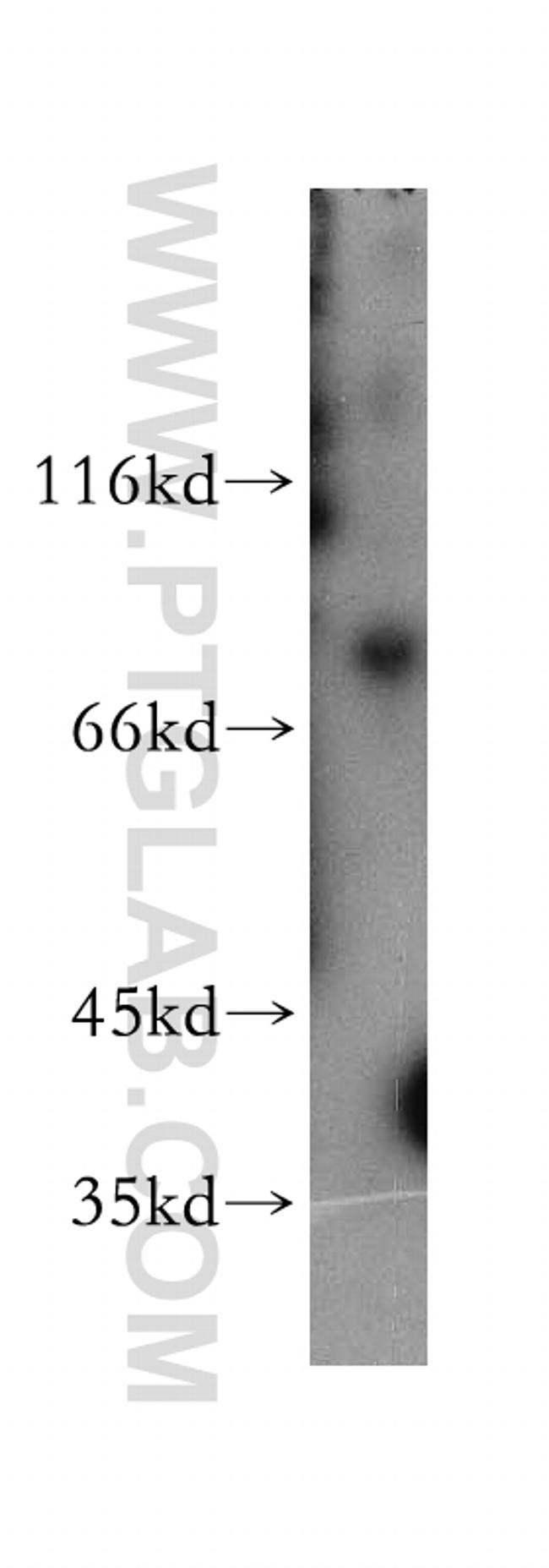 MDMX Antibody in Western Blot (WB)