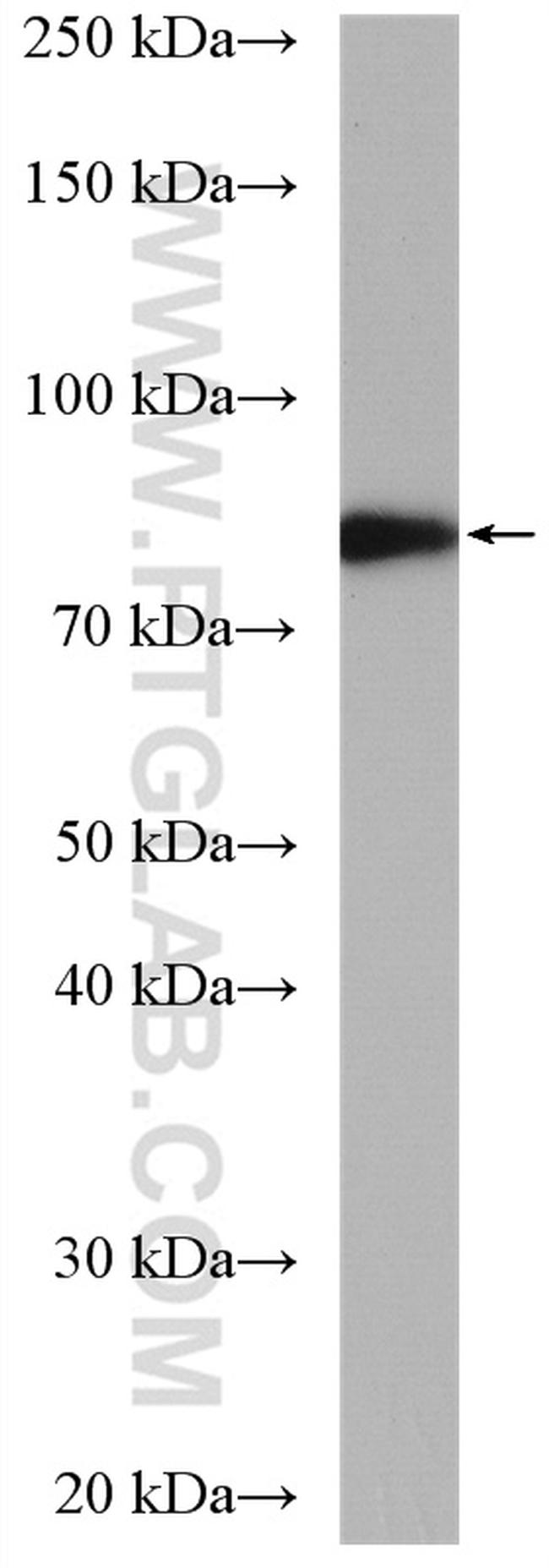 MDMX Antibody in Western Blot (WB)