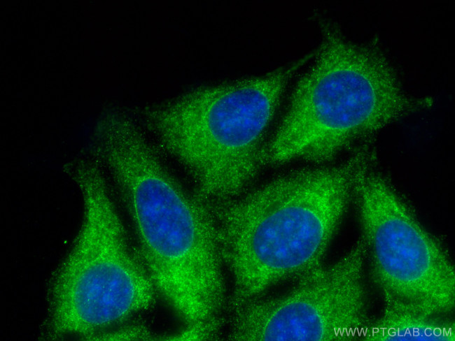 EIF4B Antibody in Immunocytochemistry (ICC/IF)