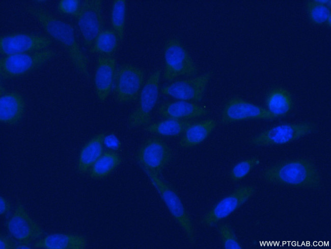 EIF4B Antibody in Immunocytochemistry (ICC/IF)