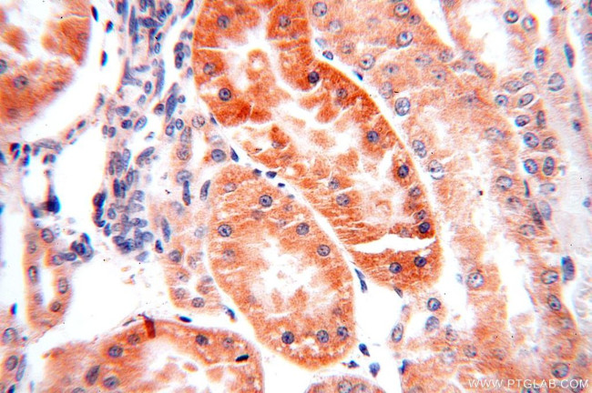 SNX5 Antibody in Immunohistochemistry (Paraffin) (IHC (P))