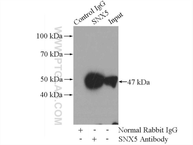 SNX5 Antibody in Immunoprecipitation (IP)