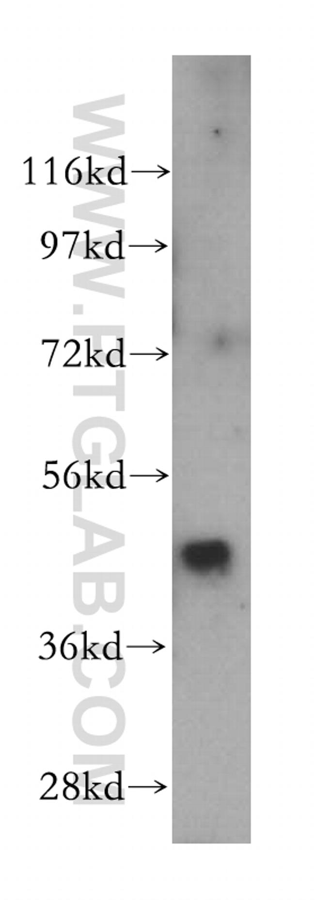 SNX5 Antibody in Western Blot (WB)