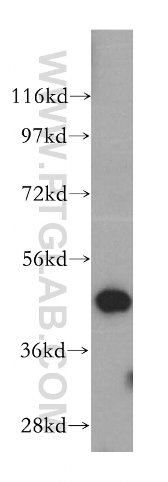 SNX5 Antibody in Western Blot (WB)