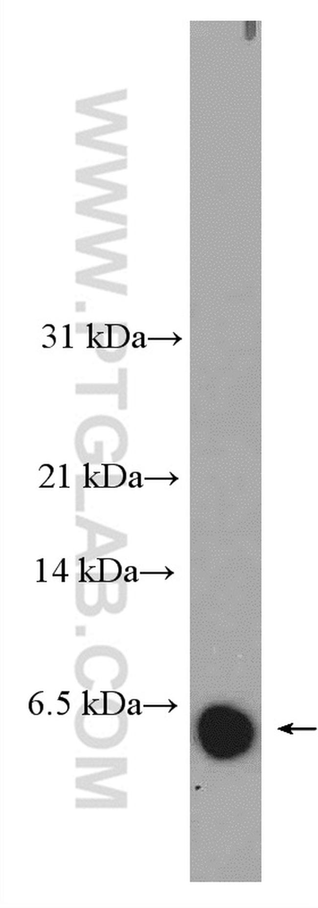 DEFA6 Antibody in Western Blot (WB)