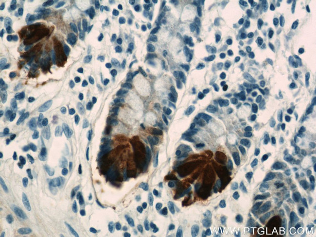 DEFA6 Antibody in Immunohistochemistry (Paraffin) (IHC (P))