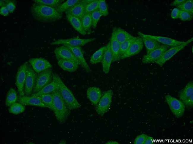 S100A5 Antibody in Immunocytochemistry (ICC/IF)