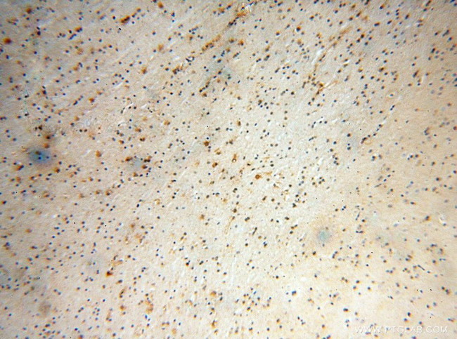 S100A5 Antibody in Immunohistochemistry (Paraffin) (IHC (P))