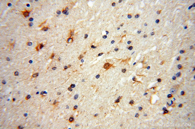 S100A5 Antibody in Immunohistochemistry (Paraffin) (IHC (P))