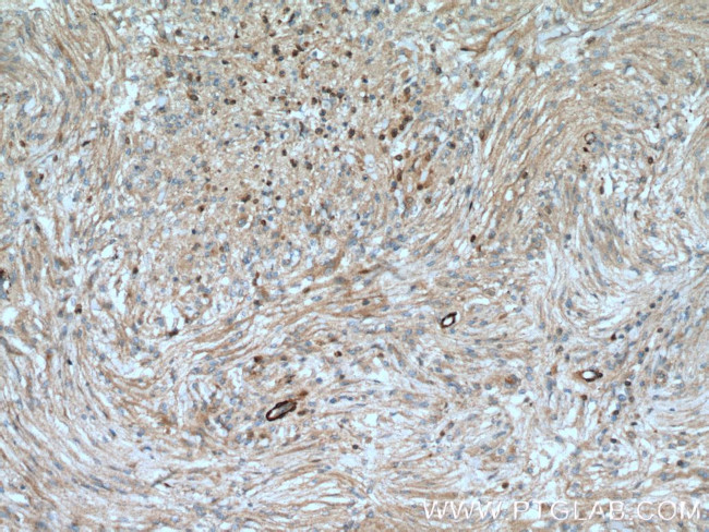 S100A5 Antibody in Immunohistochemistry (Paraffin) (IHC (P))