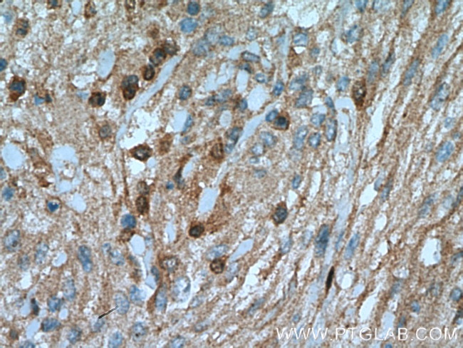 S100A5 Antibody in Immunohistochemistry (Paraffin) (IHC (P))