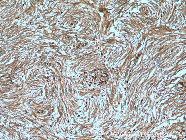 S100A5 Antibody in Immunohistochemistry (Paraffin) (IHC (P))