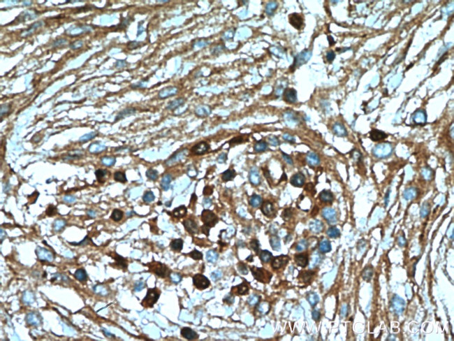 S100A5 Antibody in Immunohistochemistry (Paraffin) (IHC (P))