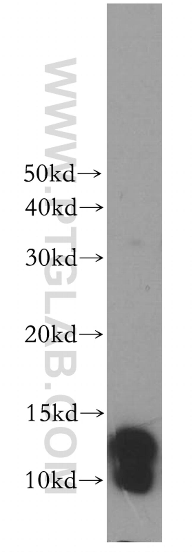 S100A5 Antibody in Western Blot (WB)