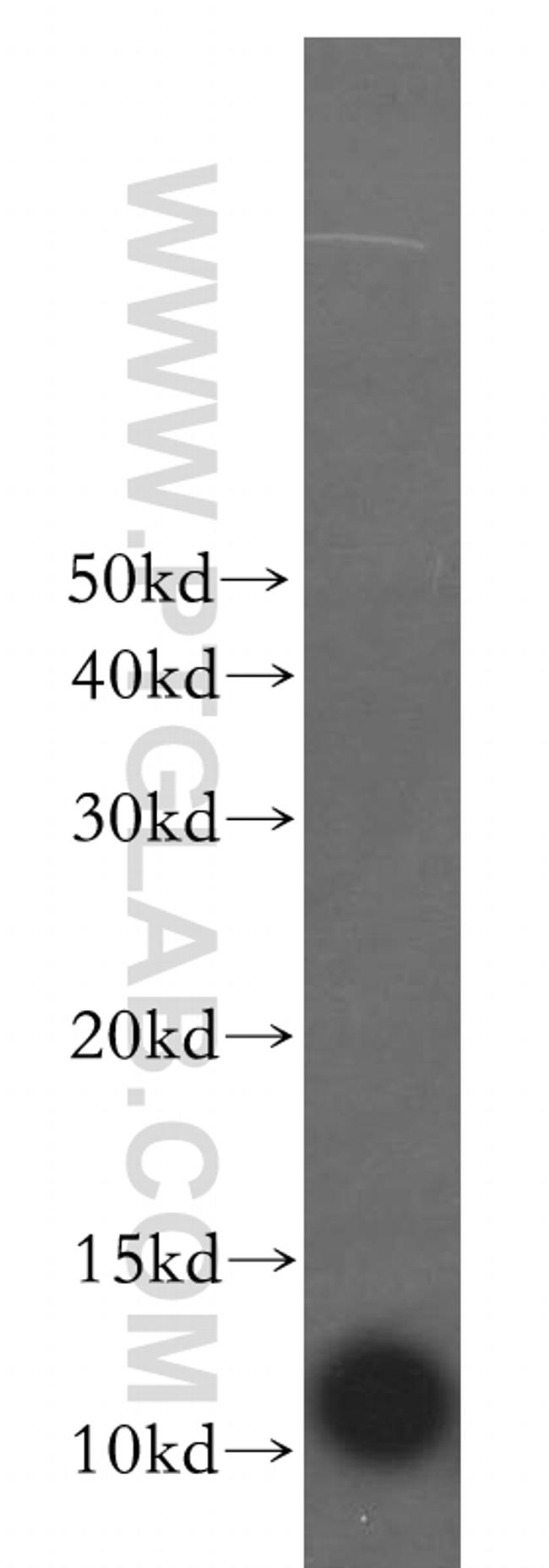 S100A5 Antibody in Western Blot (WB)