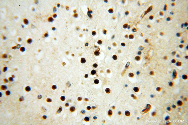 HESX1 Antibody in Immunohistochemistry (Paraffin) (IHC (P))