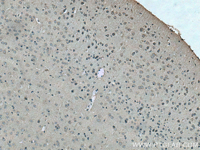 DRD1 Antibody in Immunohistochemistry (Paraffin) (IHC (P))