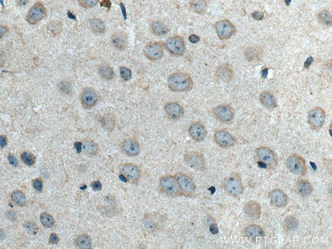 DRD1 Antibody in Immunohistochemistry (Paraffin) (IHC (P))