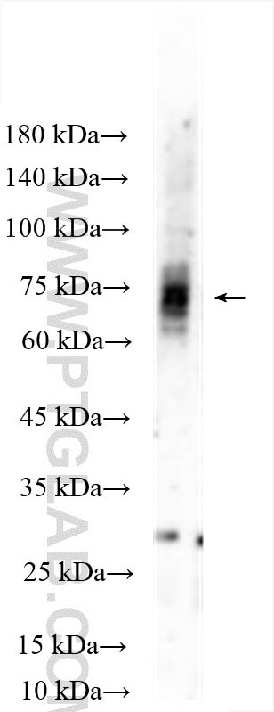 DRD1 Antibody in Western Blot (WB)