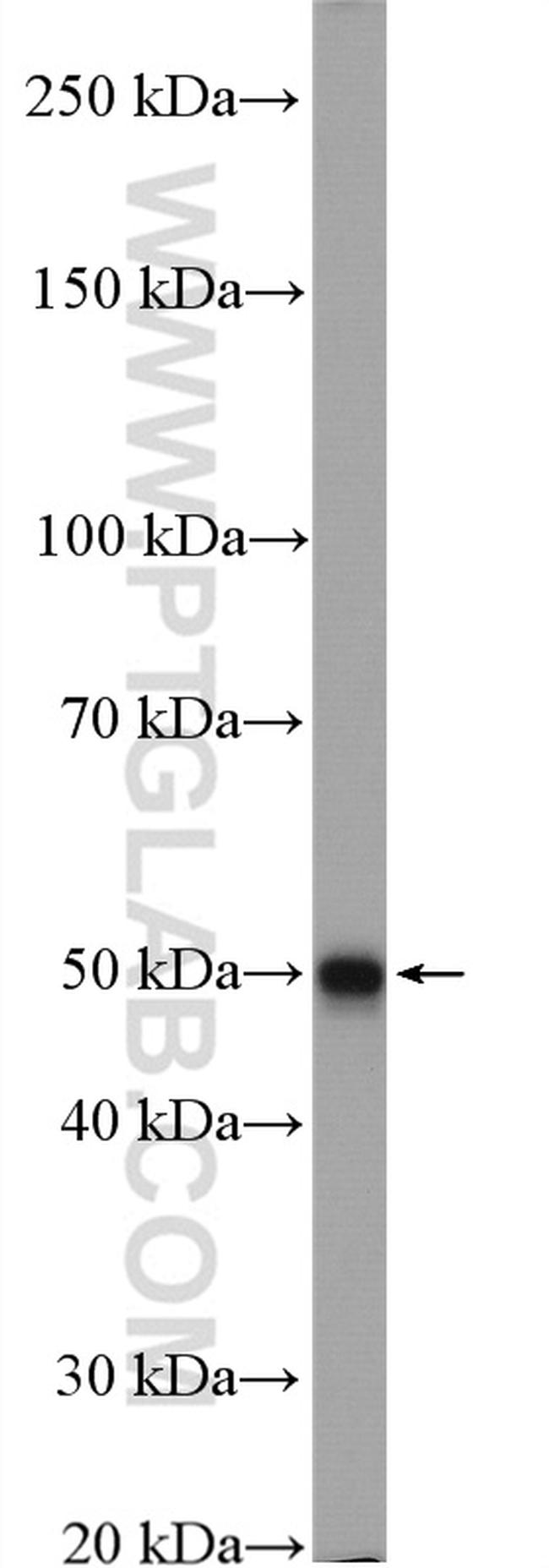 DRD1 Antibody in Western Blot (WB)