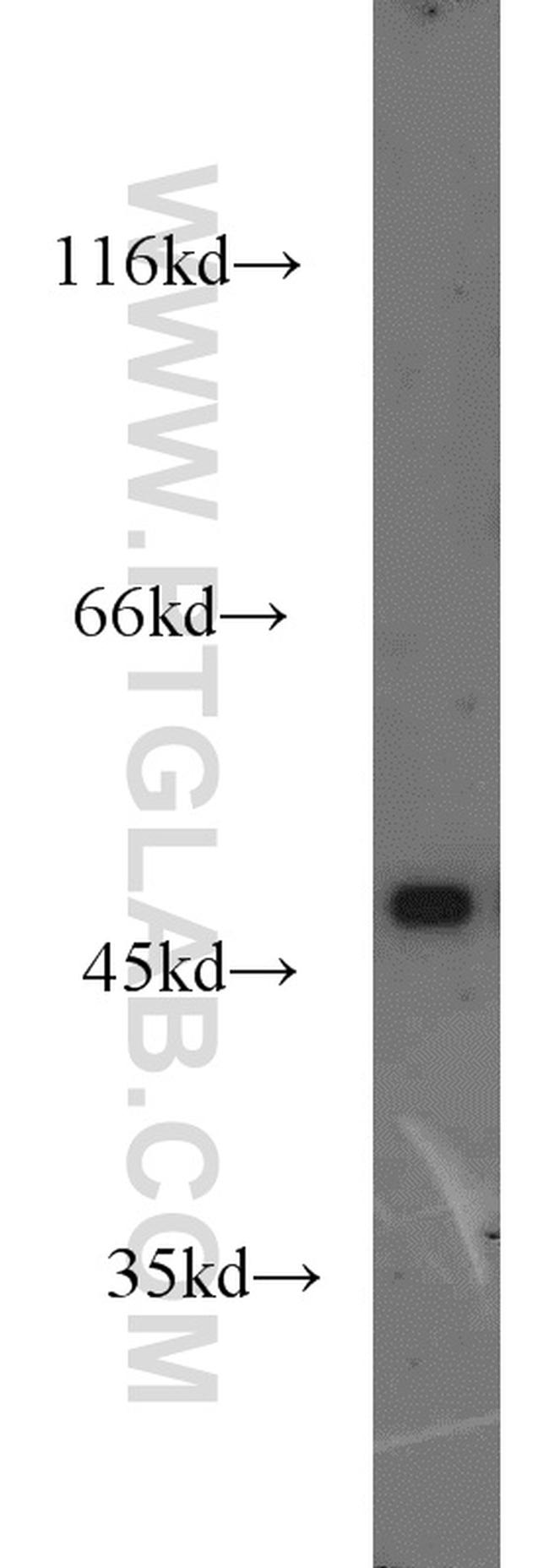 DRD1 Antibody in Western Blot (WB)