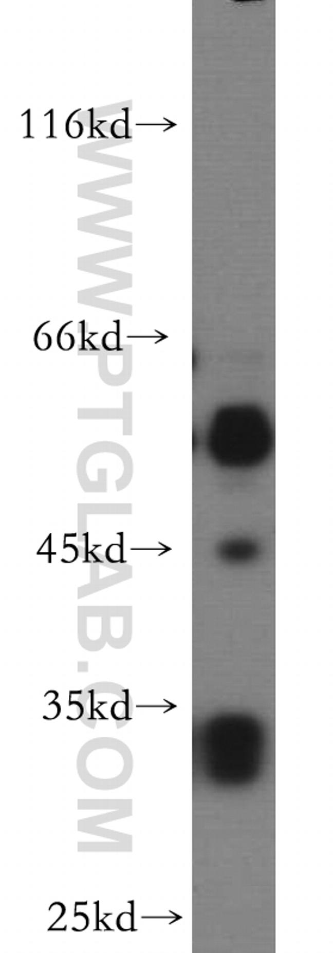 PTPRR Antibody in Western Blot (WB)