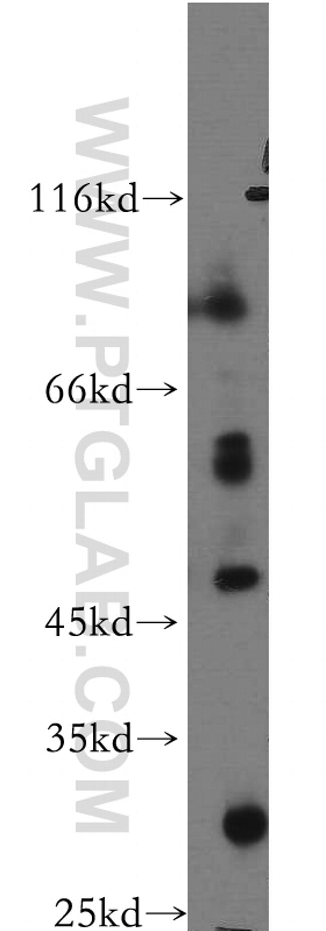 PTPRR Antibody in Western Blot (WB)