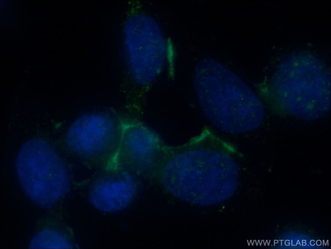 Galectin 9 Antibody in Immunocytochemistry (ICC/IF)