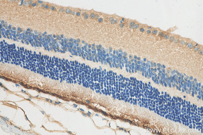 RPE65 Antibody in Immunohistochemistry (Paraffin) (IHC (P))