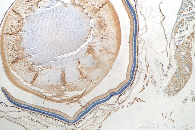 RPE65 Antibody in Immunohistochemistry (Paraffin) (IHC (P))