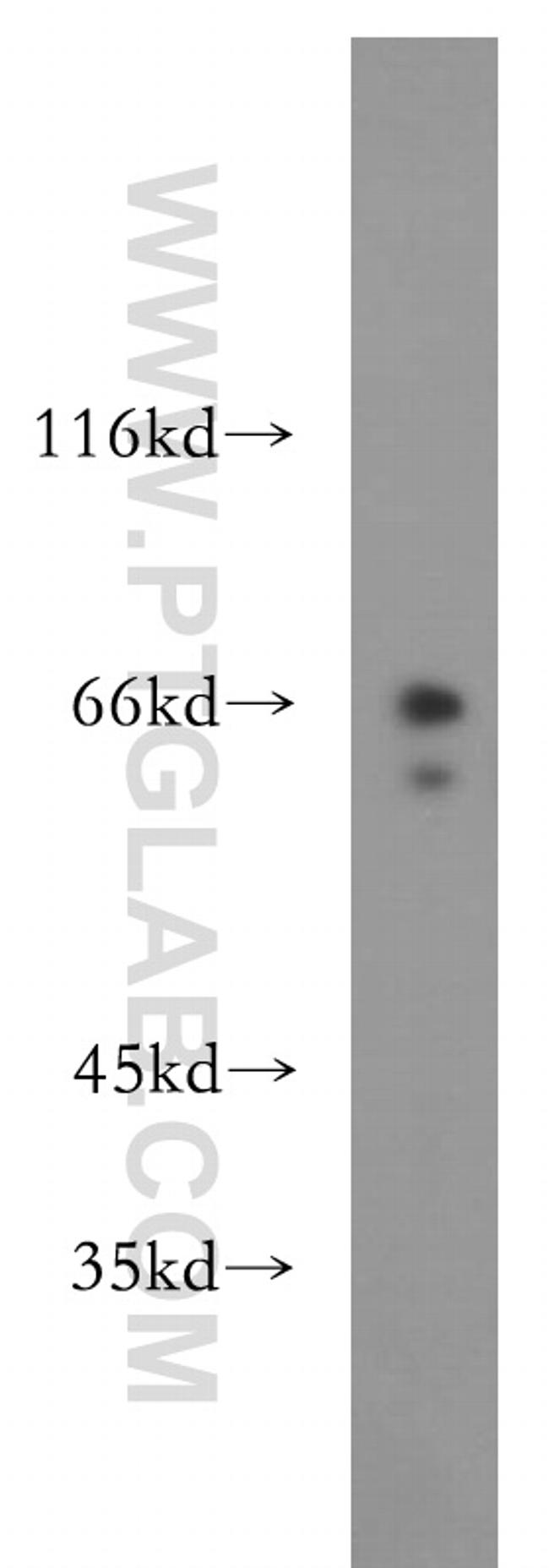 RPE65 Antibody in Western Blot (WB)