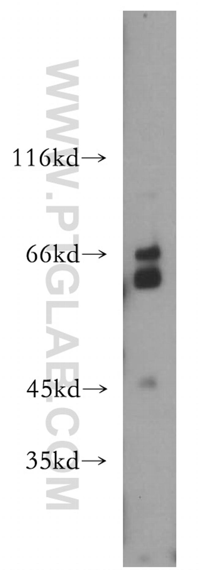 RPE65 Antibody in Western Blot (WB)