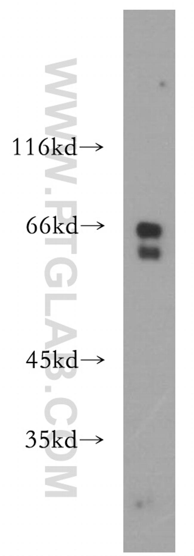 RPE65 Antibody in Western Blot (WB)