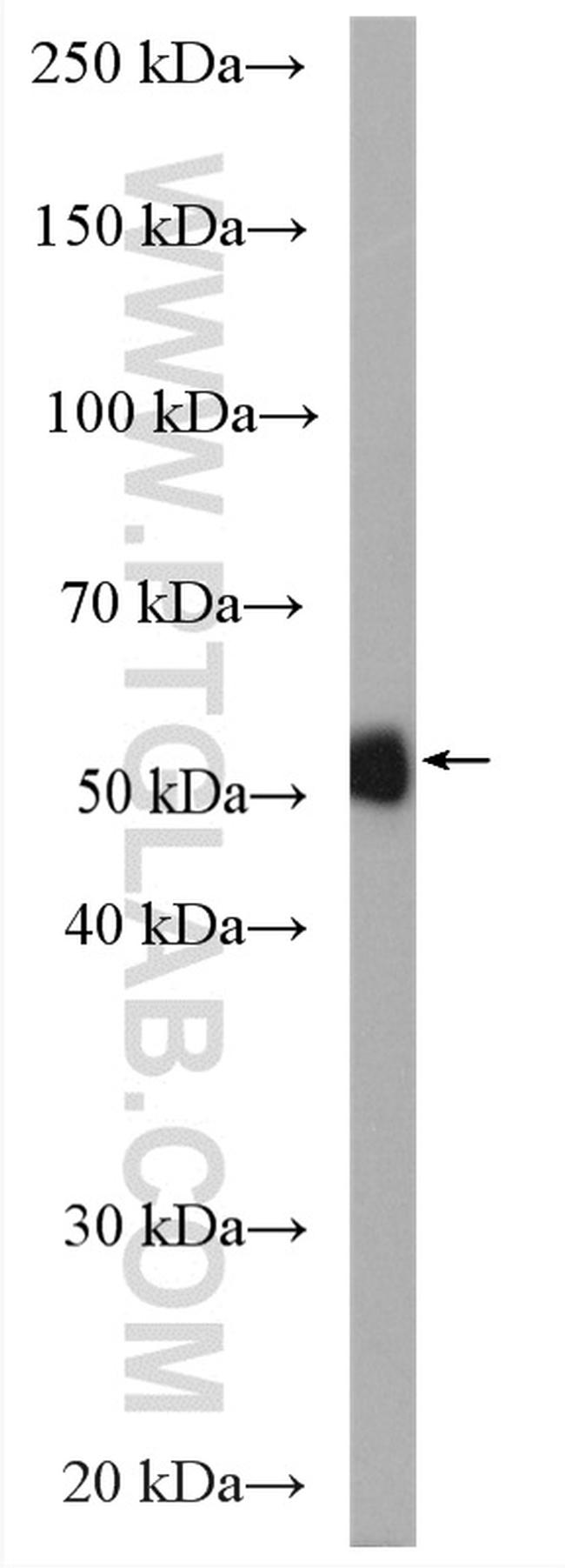 Neurokinin-1 receptor Antibody in Western Blot (WB)