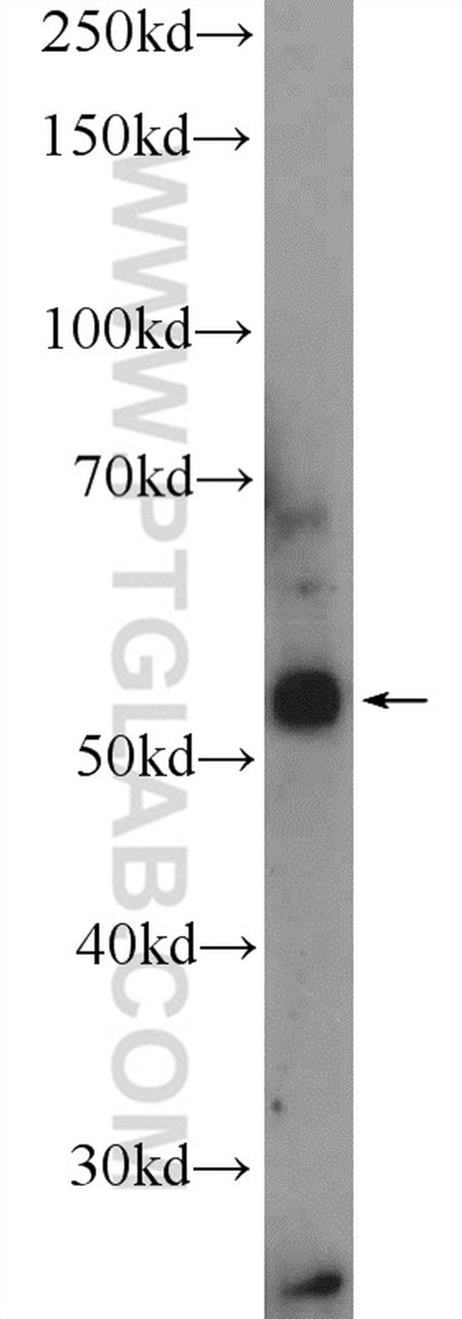 Neurokinin-1 receptor Antibody in Western Blot (WB)