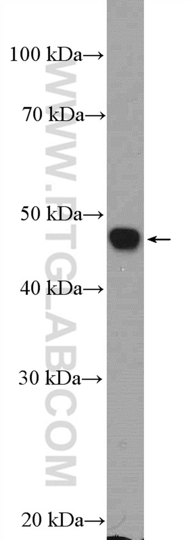 Neurokinin-1 receptor Antibody in Western Blot (WB)