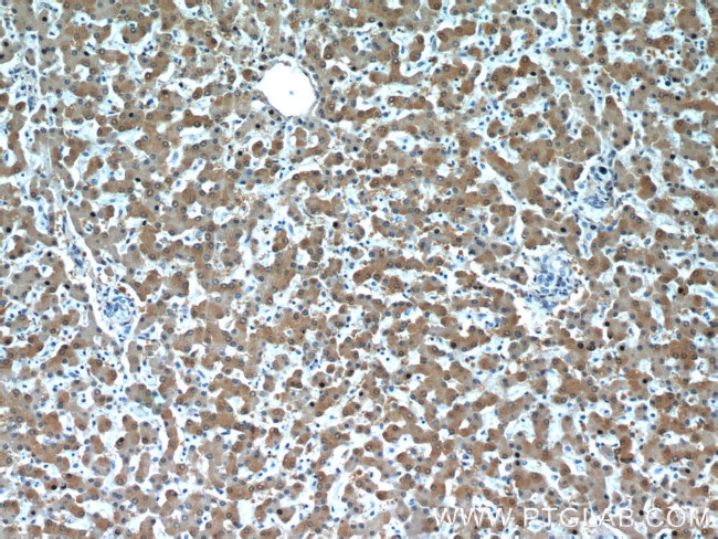 RGN/SMP30 Antibody in Immunohistochemistry (Paraffin) (IHC (P))