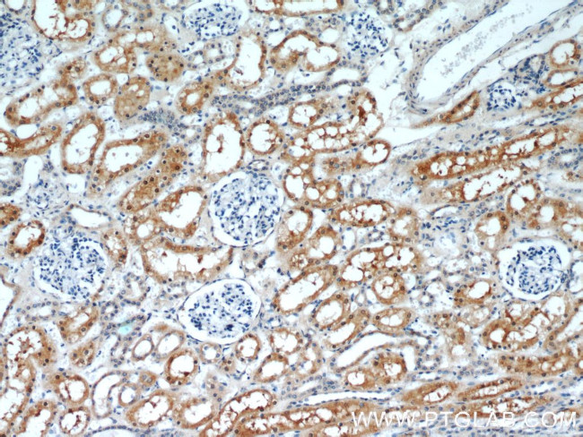 RGN/SMP30 Antibody in Immunohistochemistry (Paraffin) (IHC (P))