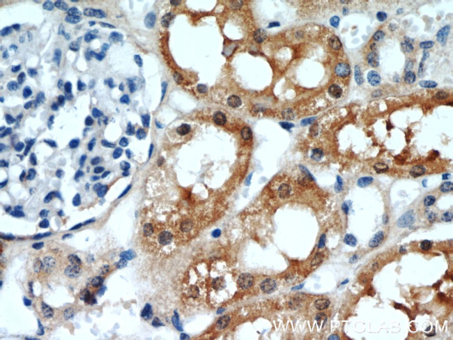 RGN/SMP30 Antibody in Immunohistochemistry (Paraffin) (IHC (P))