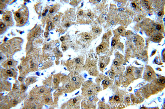 RGN/SMP30 Antibody in Immunohistochemistry (Paraffin) (IHC (P))