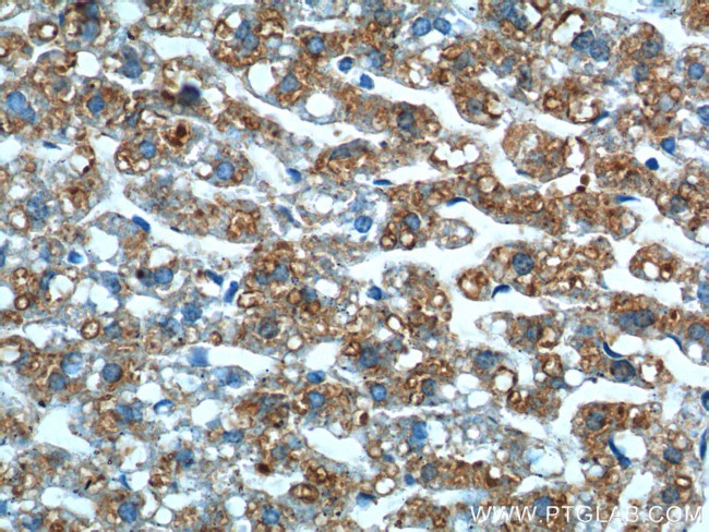 GPR177 Antibody in Immunohistochemistry (Paraffin) (IHC (P))