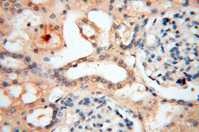 GPR177 Antibody in Immunohistochemistry (Paraffin) (IHC (P))