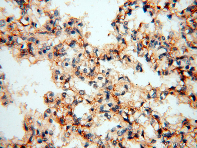 GPR177 Antibody in Immunohistochemistry (Paraffin) (IHC (P))