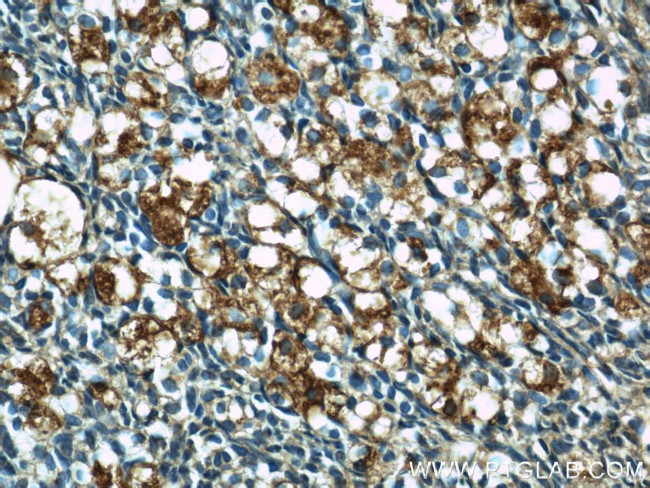 GPR177 Antibody in Immunohistochemistry (Paraffin) (IHC (P))