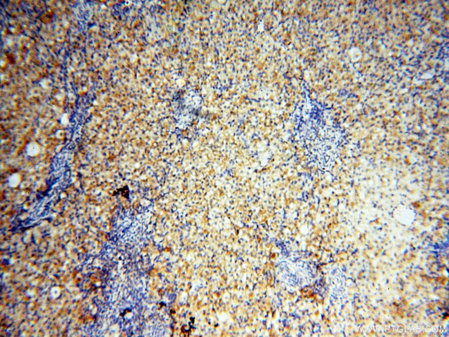 GPR177 Antibody in Immunohistochemistry (Paraffin) (IHC (P))