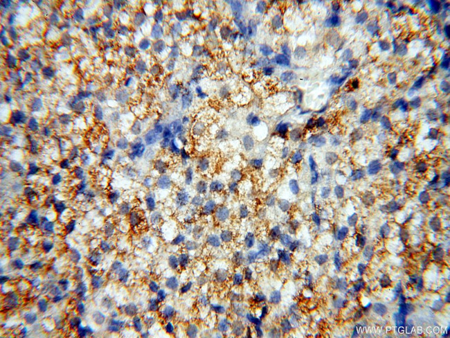 GPR177 Antibody in Immunohistochemistry (Paraffin) (IHC (P))