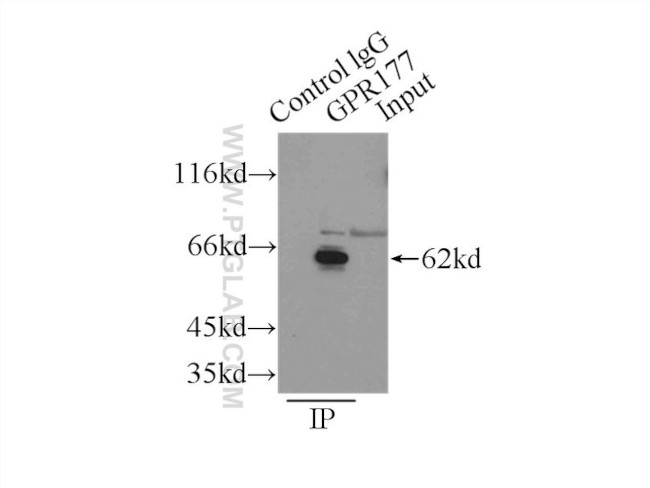 GPR177 Antibody in Immunoprecipitation (IP)