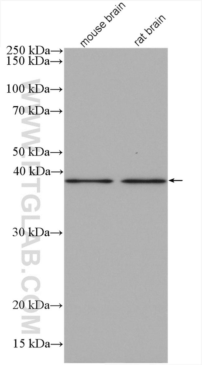 GPR177 Antibody in Western Blot (WB)